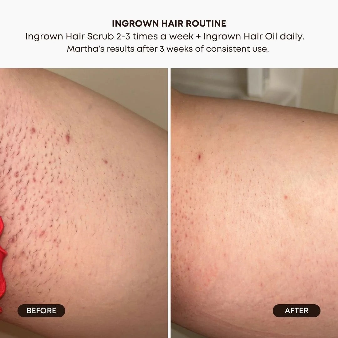 Bushbalm Ingrown Hair Exfoliating Scrub - Watermelon Sugar