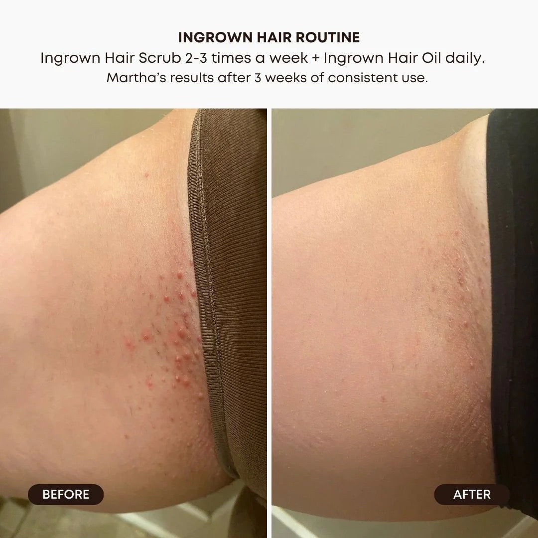 Bushbalm Ingrown Hair Exfoliating Scrub - Watermelon Sugar