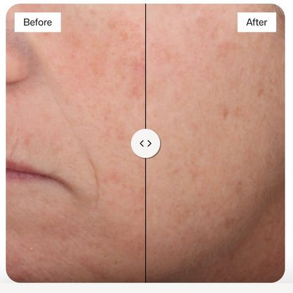 Revision Intellishade SPF 45 Original