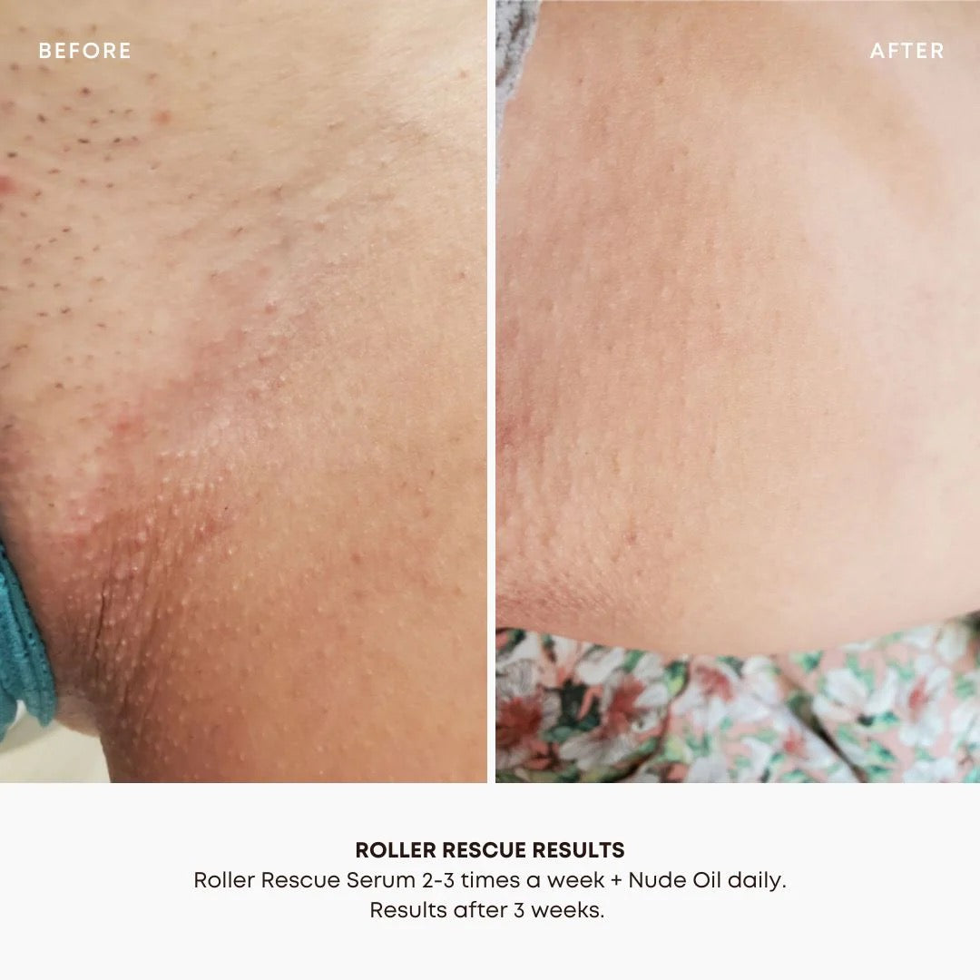 Bushbalm Roller Rescue Soothing Serum